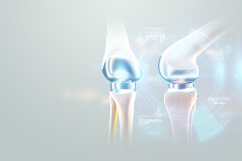 total-knee-replacement